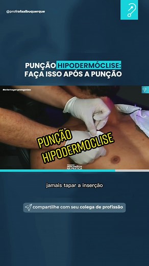 Hipodermóclise: Procedimento Passo a Passo