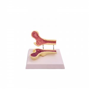 [Hot Item] Glant Femur Bone Model Anatomical Model Medical Education Training Models