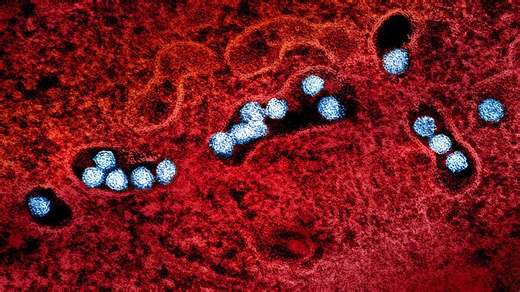 Mysterious virus with no known treatment spreads quickly along the West Coast