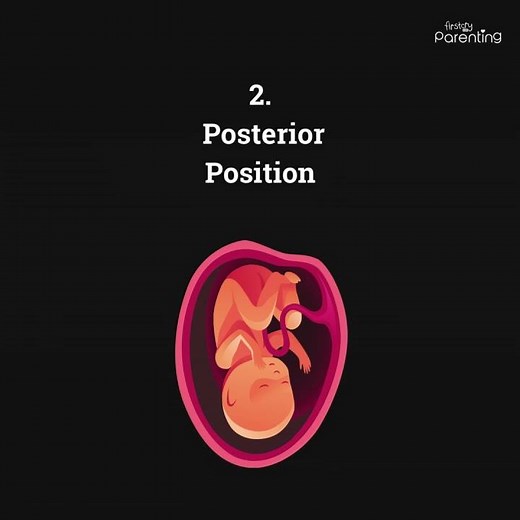 Learn about the Fetal Position in the 9th Month of Pregnancy