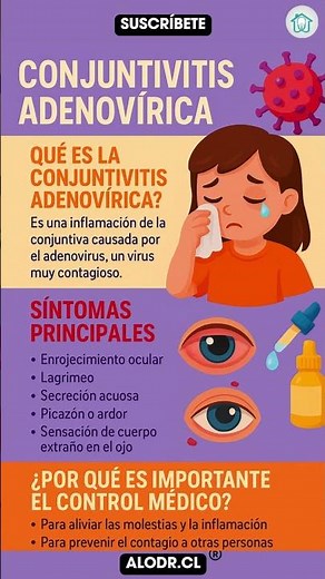 Conjuntivitis adenovírica: síntomas clave y por qué es tan contagiosa 👁️⚠️