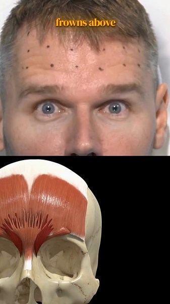 Understanding Corrugator and Frontalis Muscle Anatomy