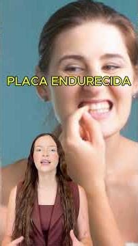 Eso Amarillo No Es Mancha: Es Sarro #sarro #tartaro #saludbucal #limpiezadental #higienedental