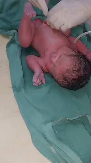 Newborn baby resuscitation👶❤✨#resuscitation #newborn #bindiyasarraff | Bindiya Verma