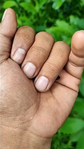 is the Smaller shiny jewel beetlepart2#beautifulinsects#nature#anyuniqueanimals#insects