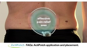 Place the device (LED light face up) so that the loop is directly over the area of pain. The therapy is also effective through light clothing. You can use any type of wraps, adhesives, bandages or clothing to help hold the ActiPatch in place. For maximum pain relief, wear continuously in one area until pain diminishes. It is not necessary to use the attachments included with the ActiPatch products. If you find it more comfortable, you can use any type of wraps, plasters, bandages or clothing to 