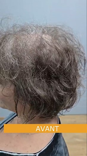 ✅ Opter pour une permanente sur un complément capillaire, c’est tout à fait possible. Si vous souhaitez une coiffure avec du volume, des boucles, des ondulations, un effet wavy... vous trouverez votre style. #prothesecapillaire #complémentcapillaire #alopecietraitement #chutedecheveux #HairSystem #vendenheim #phalsbourg | Hair System