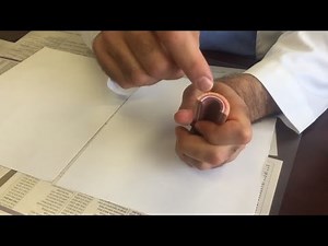 How a spontaneous coronary artery dissection happens, explained by a Novant Health cardiologist.