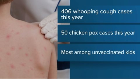 Whooping cough cases continue to soar in Clark County, with nearly 170 cases in 2 months
