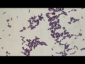 Gram staining of Enterococcus