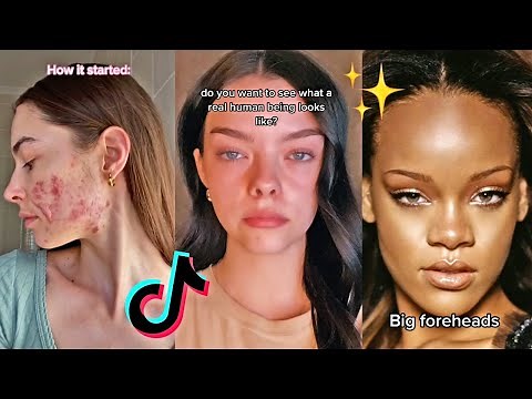 Embracing Body Insecurities (Body Positivity) *Part 4* | TikTok Compilation