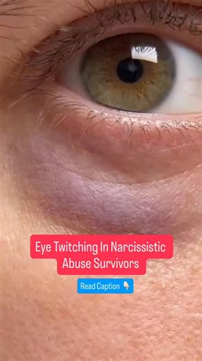 Narcissistic abuse can cause eye twitching, medically known as myokymia. Prolonged emotional abuse keeps the sympathetic nervous system the part of the body responsible for preparing us for danger constantly switched on. This ongoing state of arousal causes muscles to tighten and misfire, leading to twitches, tremors, and even facial spasms. Chronic stress also alters levels of key neurotransmitters such as dopamine, serotonin, and acetylcholine, all of which influence muscle movement. When thes