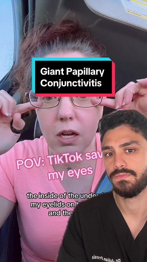 Giant Papillary Conjunctivitis: Causes, Symptoms, and Treatment