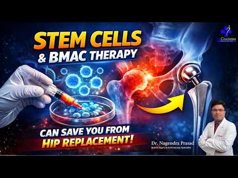 Stem Cell and BMAC Therapy for AVN Hip | AVN Hip Treatment Without surgery (Hip Replacement)