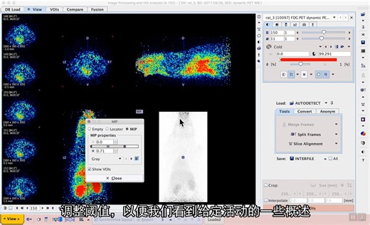 医学图像处理和分析软件 PMod（S1E7）：Image processing and VOI analysis