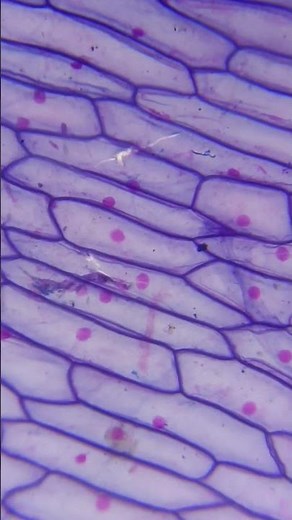 plant cells under microscope #microscope #science