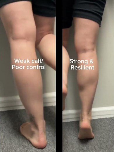 Single-Leg Heel Raise Test for Achilles Strength (Simple Self-Check)