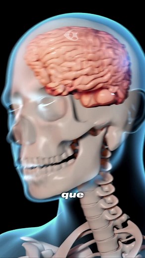 ¿Qué es una conmoción cerebral? #biologia #medicina #ciencia | what is cerebral palsy