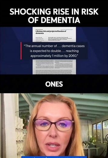 Have you heard this? 🧠⚠️ A new study says dementia risk after 55 is more than double what we thought 😔 Brain health needs cholesterol and healthy fats to function properly 🥑⚡ Statins, low fat diets, and seed oils may be doing more harm than good 🧩 Our neurons need the right fuel to remember, think, and connect ❤️ 🎥 Clip credit: @pbsnews Food for thought. Literally. #brainhealth #dementia #cholesterol #healthyfats #statins