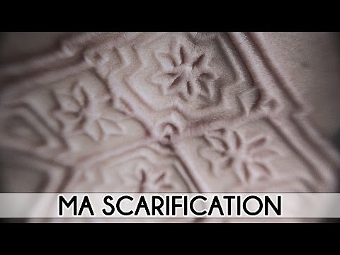 Modification corporelle : ma scarification