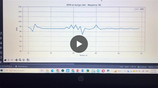 #biomedicalengineering #arduino #python #innovation #healthcare #embeddedsystems | Aimane ETTARRACH