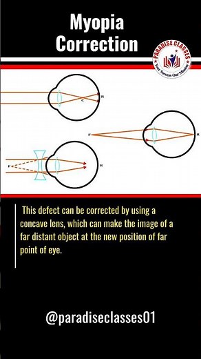 Myopia Correction Using Concave Lens | Physics Human Eye | Paradise Classes