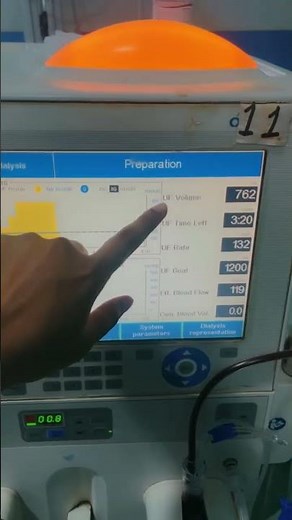 🩺 Dialysis Machine Explained | How Dialysis Works | Nurse’s Viewpoint