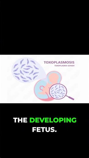 Toxoplasmosis: Risks in Pregnancy Explained!
