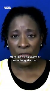 Things I Saw As A Surgery Tech Changed Me - Part 1 | Miracle Survivors