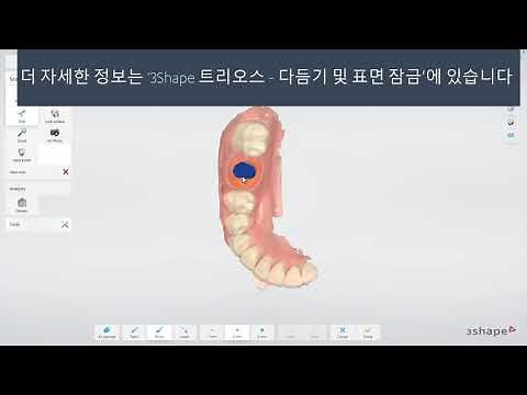 3Shape 트리오스 – 임플란트 워크플로 - TRIOS - Implant restoration workflow