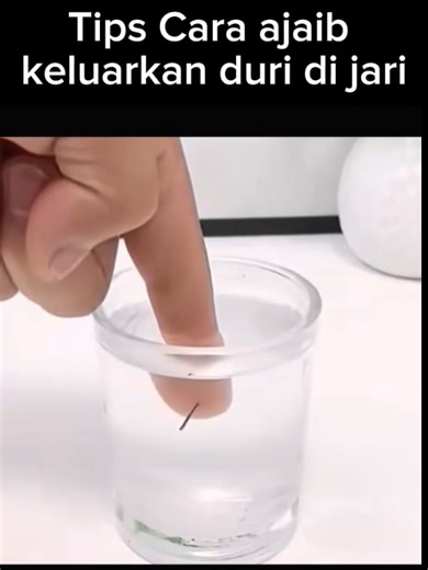 Tips Mengeluarkan Duri di Jari Secara Praktis