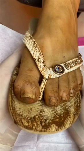 ✅Most Easy Pedicure At Home | Get Fair & Smooth Feet, Remove Dirt & Tanning Easily #shorts #beauty