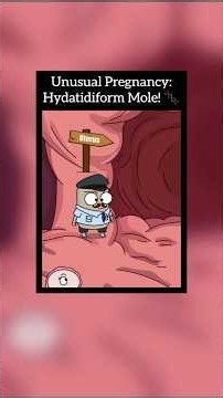 What ACTUALLY Causes a Hydatidiform Mole (Molar Pregnancy)? 🧬 #Obstetrics