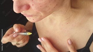 Woman performing mesotherapy, bio revitalization procedure, injecting medecine in her neck and face. Cosmetics