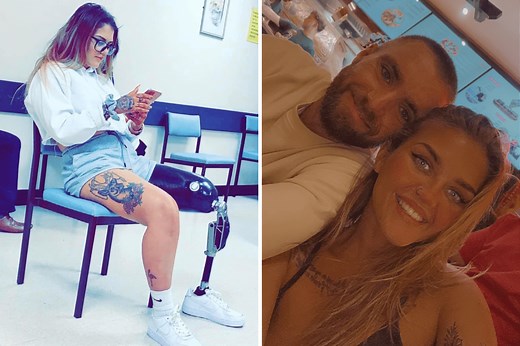 Woman Finds Love After Unexpected Amputation That Made Her Feel ‘Unwanted’