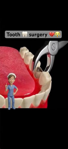 How tooth extraction surgery is performed #3danimation #health #science #toothanatomy