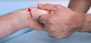 Traction-Shift Test / Subluxation Relocation Test | Thumb CMC1 OA