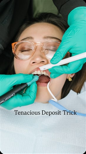 Hygiene Edge | Try this next time you have a deposit that does not want to budge or something that’s burnished. Making sure the tip is 100% on calculus is... | Instagram