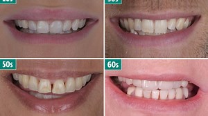 Time-lapse video reveals how your teeth will change in each decade of life