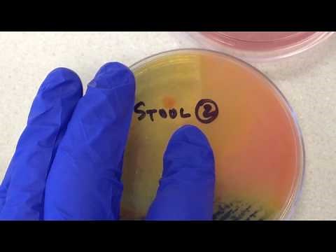 Plate Reading - Stool II