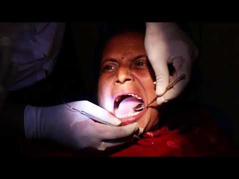 Extraction of adult teeth