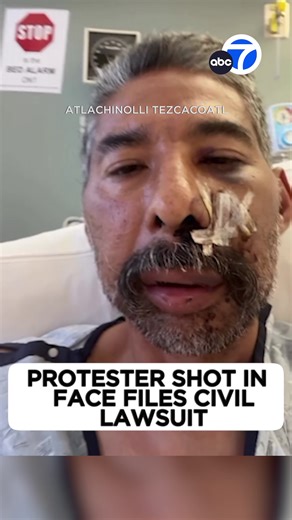 Civil Rights Lawsuit Against LAPD Over Foam Projectile Incident