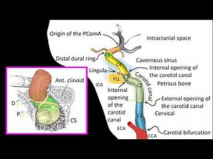 Internal Carotid Artery Segments