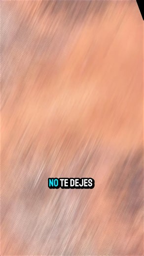 53K views · 2.3K reactions | No te dejes engañar con puntos negros o...