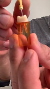 2.1K views · 98 reactions | Want to learn Endo "Over the Shoulder"...