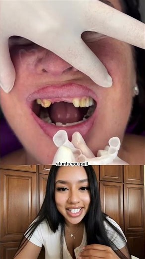 DON'T RUIN YOUR SMILE! ⚠️ #teeth