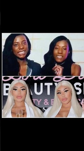 Clermont Twins before surgery #bcg #kardashians #instamodels #instagramreels #yt #instadaily #model