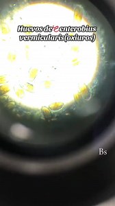 48K views · 748 reactions | Stool sample ❤️ #lablife #parasites #microbiology | Lab life | Facebook