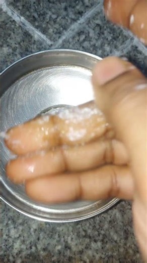 Tip to remove feviquick marks on skin #hand #finger #feviquick #feviquickremovalfromhand #gumremoval