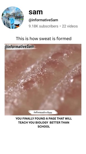 Do you know | how sweat is formed #brainlearning #biologyscience #medicaleducation